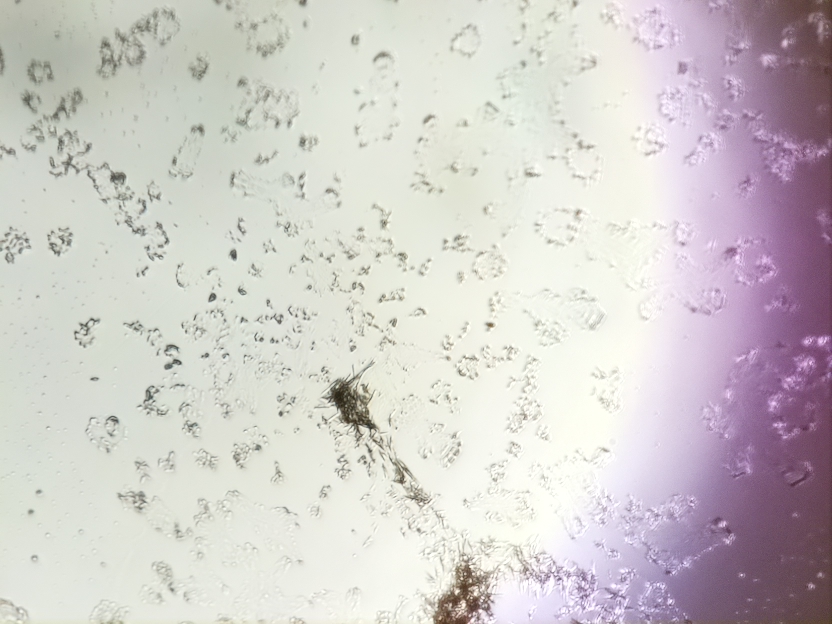Experimental microscope image from the optical tweezer project